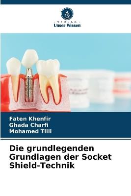 Die grundlegenden Grundlagen der Socket Shield-Technik - Faten Khenfir,Ghada Charfi,Mohamed Tlili - cover