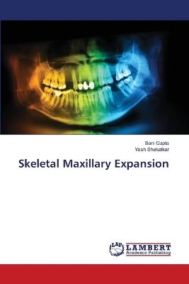 Skeletal Maxillary Expansion - Soni Gupta,Yash Shekatkar - cover