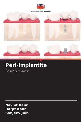 Péri-implantite - Navnit Kaur,Harjit Kaur,Sanjeev Jain - cover