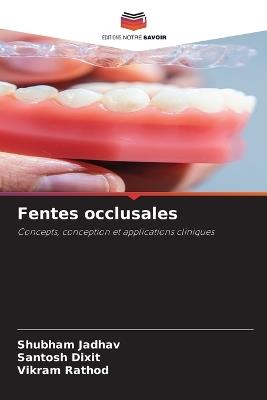 Fentes occlusales - Shubham Jadhav,Santosh Dixit,Vikram Rathod - cover