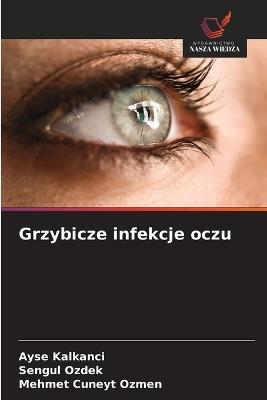 Grzybicze infekcje oczu - Ayse Kalkanci,Sengul Ozdek,Mehmet Cuneyt Ozmen - cover