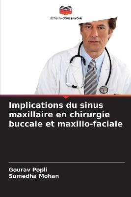 Implications du sinus maxillaire en chirurgie buccale et maxillo-faciale - Gourav Popli,Sumedha Mohan - cover