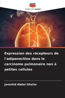 Expression des récepteurs de l'adiponectine dans le carcinome pulmonaire non à petites cellules - Jamshid Abdul Ghafar - cover