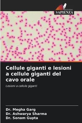 Cellule giganti e lesioni a cellule giganti del cavo orale - Megha Garg,Ashwarya Sharma,Sonam Gupta - cover