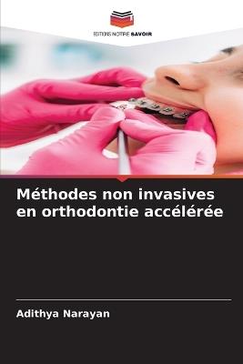 Méthodes non invasives en orthodontie accélérée - Adithya Narayan - cover