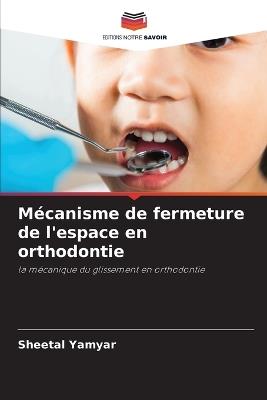 Mécanisme de fermeture de l'espace en orthodontie - Sheetal Yamyar - cover