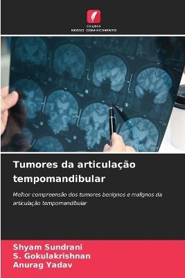 Tumores da articulação tempomandibular - Shyam Sundrani,S Gokulakrishnan,Anurag Yadav - cover