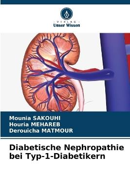 Diabetische Nephropathie bei Typ-1-Diabetikern - Mounia Sakouhi,Houria Mehareb,Derouicha Matmour - cover