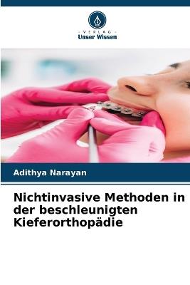 Nichtinvasive Methoden in der beschleunigten Kieferorthopädie - Adithya Narayan - cover