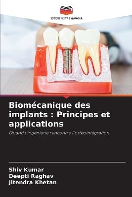 Biomécanique des implants: Principes et applications - Shiv Kumar,Deepti Raghav,Jitendra Khetan - cover