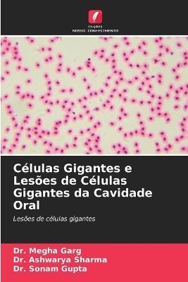 Células Gigantes e Lesões de Células Gigantes da Cavidade Oral - Megha Garg,Ashwarya Sharma,Sonam Gupta - cover