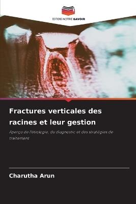 Fractures verticales des racines et leur gestion - Charutha Arun - cover
