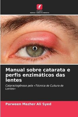 Manual sobre catarata e perfis enzimáticos das lentes - Parween Mazher Ali Syed - cover