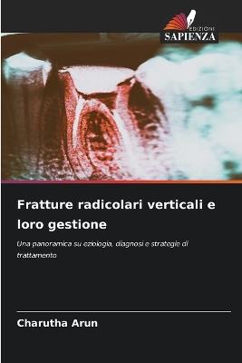 Fratture radicolari verticali e loro gestione - Charutha Arun - cover