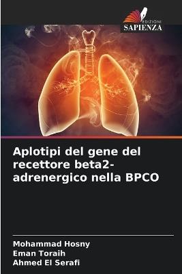 Aplotipi del gene del recettore beta2-adrenergico nella BPCO - Mohammad Hosny,Eman Toraih,Ahmed El Serafi - cover