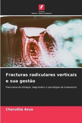 Fracturas radiculares verticais e sua gestão - Charutha Arun - cover