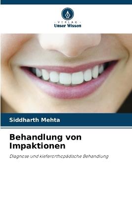 Behandlung von Impaktionen - Siddharth Mehta - cover
