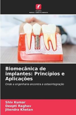 Biomecânica de implantes: Princípios e Aplicações - Shiv Kumar,Deepti Raghav,Jitendra Khetan - cover