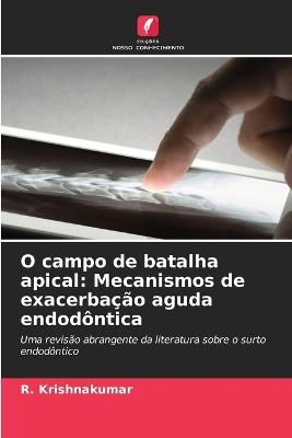 O campo de batalha apical: Mecanismos de exacerbação aguda endodôntica - R Krishnakumar - cover