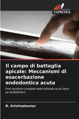 Il campo di battaglia apicale: Meccanismi di esacerbazione endodontica acuta - R Krishnakumar - cover