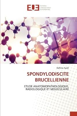 Spondylodiscite Brucellienne - Rahma Ayadi - cover