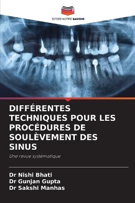 Différentes Techniques Pour Les Procédures de Soulèvement Des Sinus - Nishi Bhati,Gunjan Gupta,Sakshi Manhas - cover