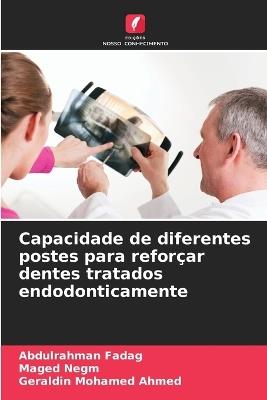 Capacidade de diferentes postes para reforçar dentes tratados endodonticamente - Abdulrahman Fadag,Maged Negm,Geraldin Mohamed Ahmed - cover