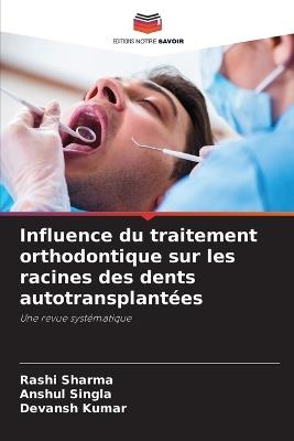 Influence du traitement orthodontique sur les racines des dents autotransplantées - Rashi Sharma,Anshul Singla,Devansh Kumar - cover