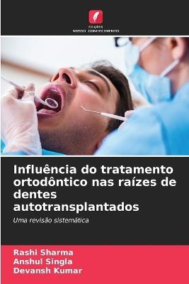 Influência do tratamento ortodôntico nas raízes de dentes autotransplantados - Rashi Sharma,Anshul Singla,Devansh Kumar - cover