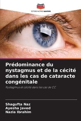 Prédominance du nystagmus et de la cécité dans les cas de cataracte congénitale - Shagufta Naz,Ayesha Javed,Nazia Ibrahim - cover