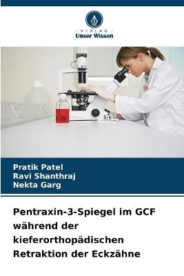 Pentraxin-3-Spiegel im GCF während der kieferorthopädischen Retraktion der Eckzähne - Pratik Patel,Ravi Shanthraj,Nekta Garg - cover
