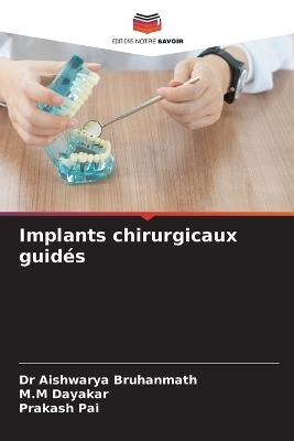Implants chirurgicaux guidés - Aishwarya Bruhanmath,M M Dayakar,Prakash Pai - cover