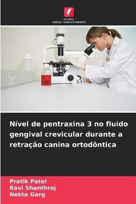 Nível de pentraxina 3 no fluido gengival crevicular durante a retração canina ortodôntica - Pratik Patel,Ravi Shanthraj,Nekta Garg - cover