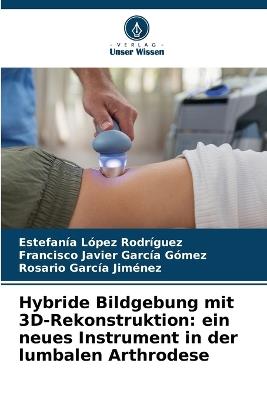 Hybride Bildgebung mit 3D-Rekonstruktion: ein neues Instrument in der lumbalen Arthrodese - Estefanía López Rodríguez,Francisco Javier García Gómez,Rosario García Jiménez - cover