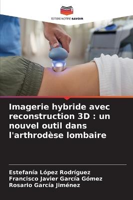 Imagerie hybride avec reconstruction 3D: un nouvel outil dans l'arthrodèse lombaire - Estefanía López Rodríguez,Francisco Javier García Gómez,Rosario García Jiménez - cover
