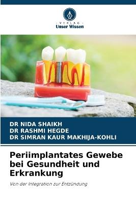 Periimplantates Gewebe bei Gesundheit und Erkrankung - Nida Shaikh,Rashmi Hegde,Simran Kaur Makhija-Kohli - cover