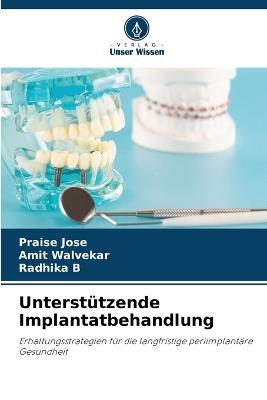 Unterstützende Implantatbehandlung - Praise Jose,Amit Walvekar,Radhika B - cover