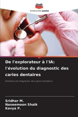 De l'explorateur à l'IA: l'évolution du diagnostic des caries dentaires - Sridhar M,Naseemoon Shaik,Kavya P - cover