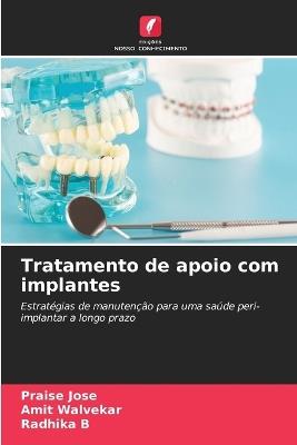 Tratamento de apoio com implantes - Praise Jose,Amit Walvekar,Radhika B - cover