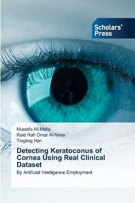 Detecting Keratoconus of Cornea Using Real Clinical Dataset - Mustafa Ali Malla,Raid Rafi Omar Al-Nima,Tingting Han - cover
