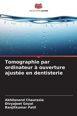 Tomographie par ordinateur à ouverture ajustée en dentisterie - Akhilanand Chaurasia,Divyajeet Goyal,Ranjitkumar Patil - cover