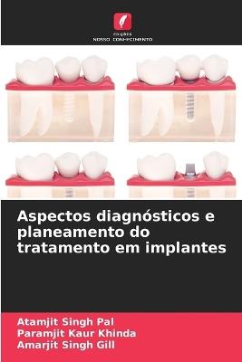 Aspectos diagnósticos e planeamento do tratamento em implantes - Atamjit Singh Pal,Paramjit Kaur Khinda,Amarjit Singh Gill - cover