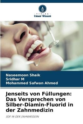 Jenseits von Füllungen: Das Versprechen von Silber-Diamin-Fluorid in der Zahnmedizin - Naseemoon Shaik,Sridhar M,Mohammed Safwan Ahmed - cover