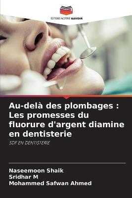 Au-delà des plombages: Les promesses du fluorure d'argent diamine en dentisterie - Naseemoon Shaik,Sridhar M,Mohammed Safwan Ahmed - cover