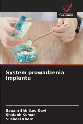 System prowadzenia implantu - Sapam Shinttoo Devi,Shalabh Kumar,Susheel Khera - cover