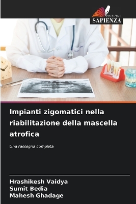 ibs