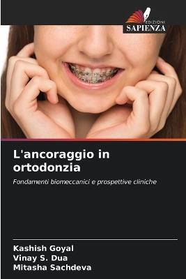 L'ancoraggio in ortodonzia - Kashish Goyal,Vinay S Dua,Mitasha Sachdeva - cover