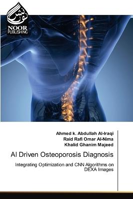 AI Driven Osteoporosis Diagnosis - Ahmed K Abdullah Al-Iraqi,Raid Rafi Omar Al-Nima,Khalid Ghanim Majeed - cover