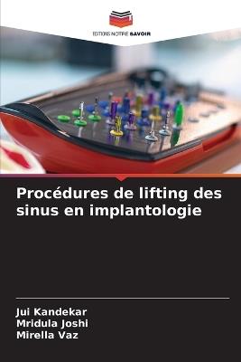 Procédures de lifting des sinus en implantologie - Jui Kandekar,Mridula Joshi,Mirella Vaz - cover