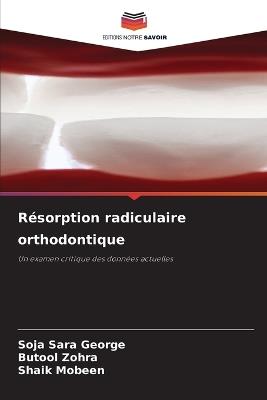 Résorption radiculaire orthodontique - Soja Sara George,Butool Zohra,Shaik Mobeen - cover